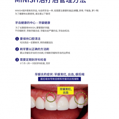 MINISH后注意事项