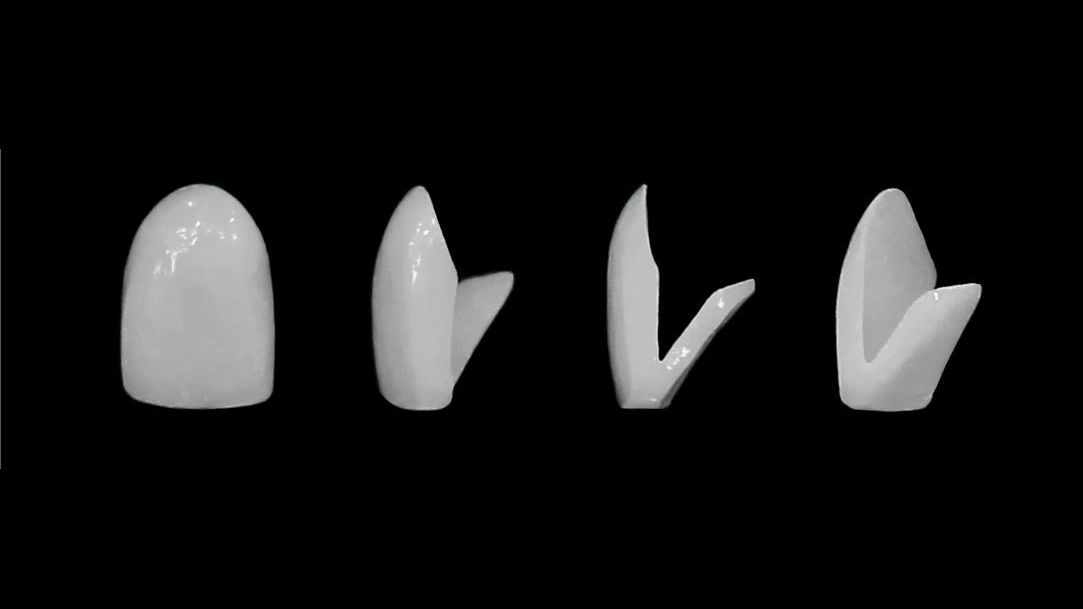 MINISH牙科|MINISH种植牙|MINISH种植牙价格|MINISH全瓷牙修复|MINISH牙科医院|MINISH牙齿贴面|韩国牙科医院|韩国牙齿整形医院|韩国牙齿美容医院|韩国牙科整形价格